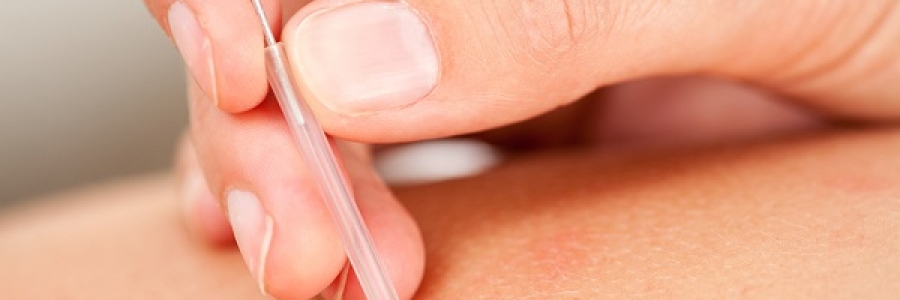 האם דיקור סיני יכול לסייע במחלות עור שונות?